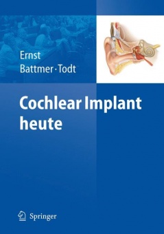 Cochlear Implant heute 